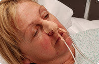 Dale Medical Nasogastric Tube Holder